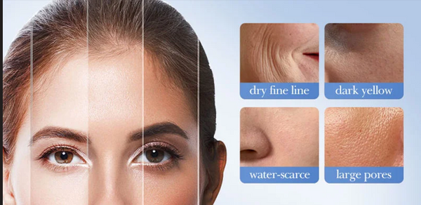 Crema Facial Hidratante Iluminadora con Niacinamida y Arroz – Piel Radiante y Sin Manchas